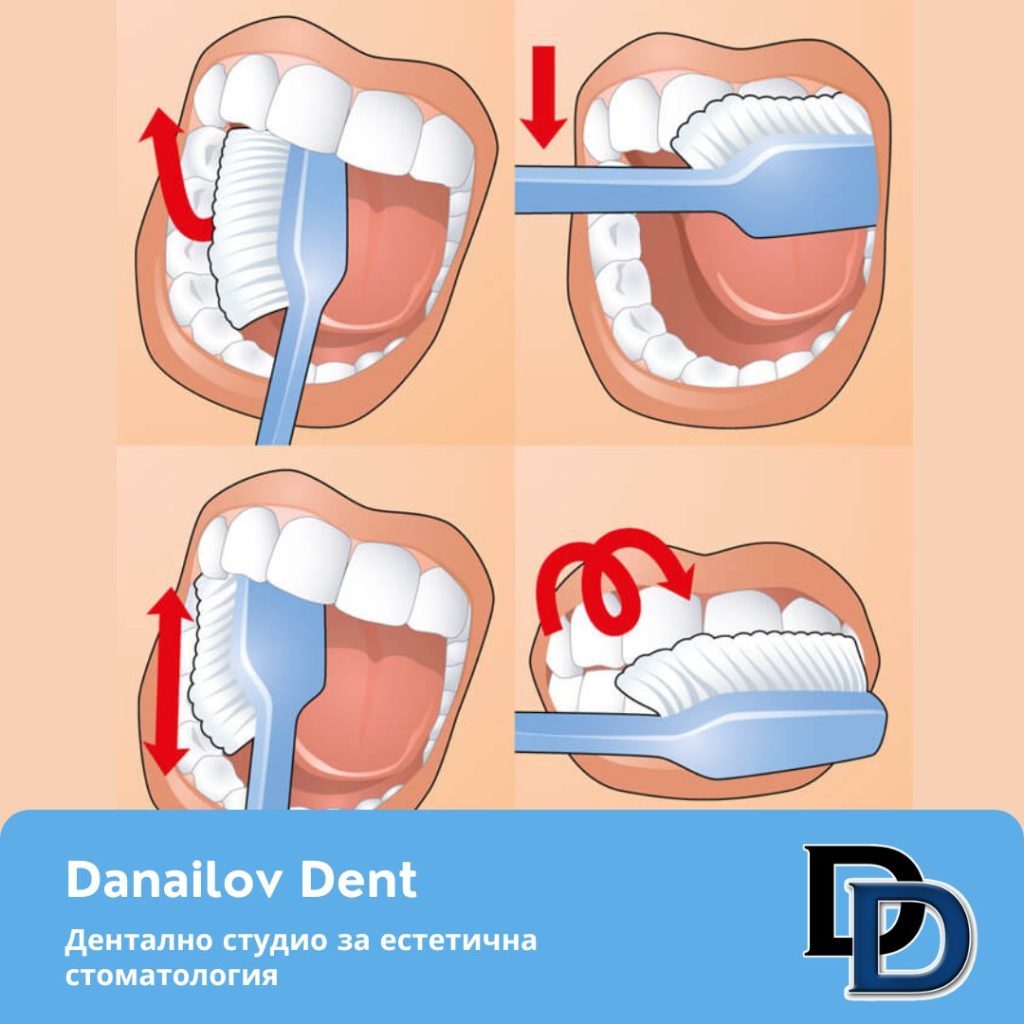 kak-da-pochistvame-zybite-danailovdent-1024x1024.jpg