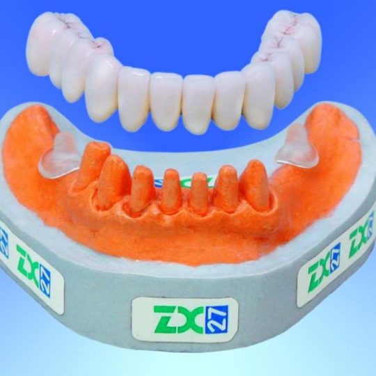 styklena oporna sistema zh27 danailovdent1