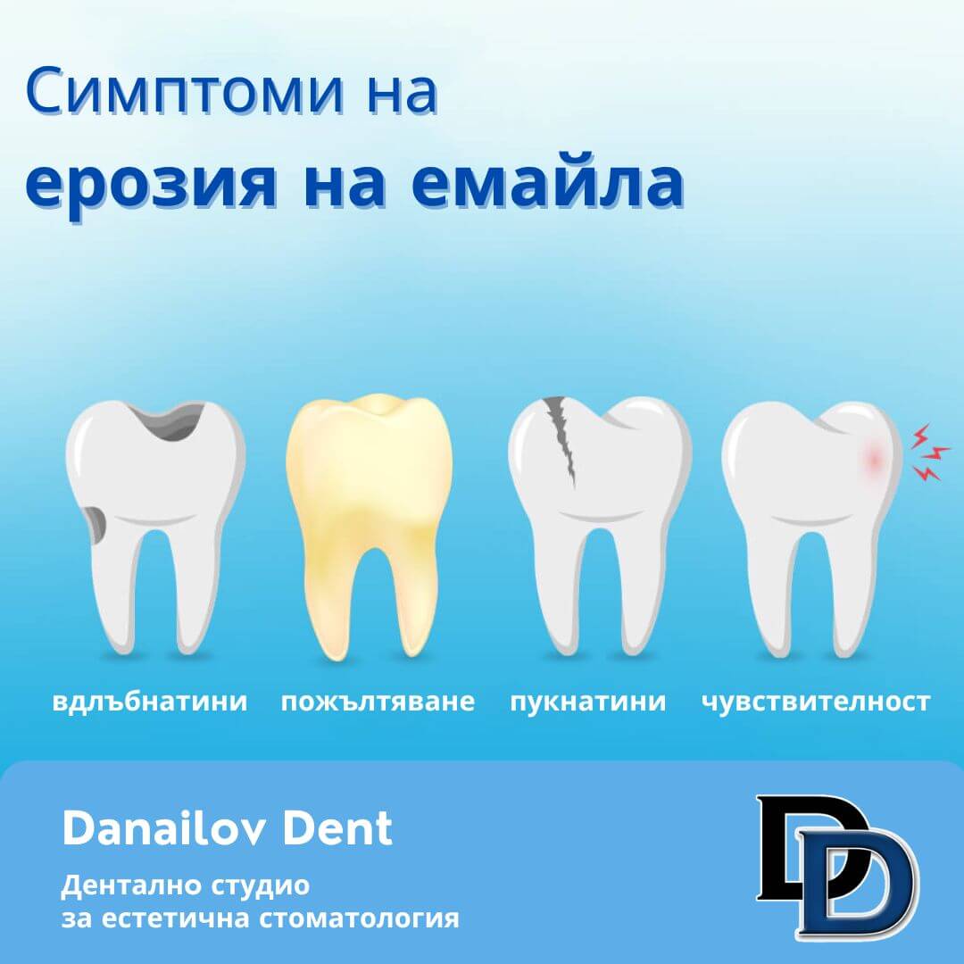 Ерозия на зъбния емайл 1 симптоми на ерозия на зъбния емайл