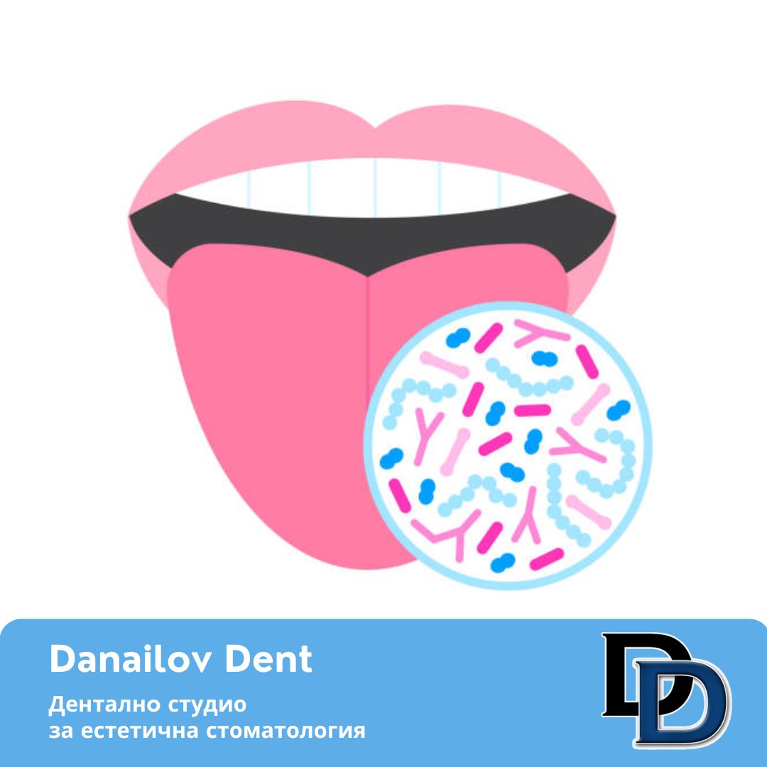 oralna-microbioma-danailovdent.jpg