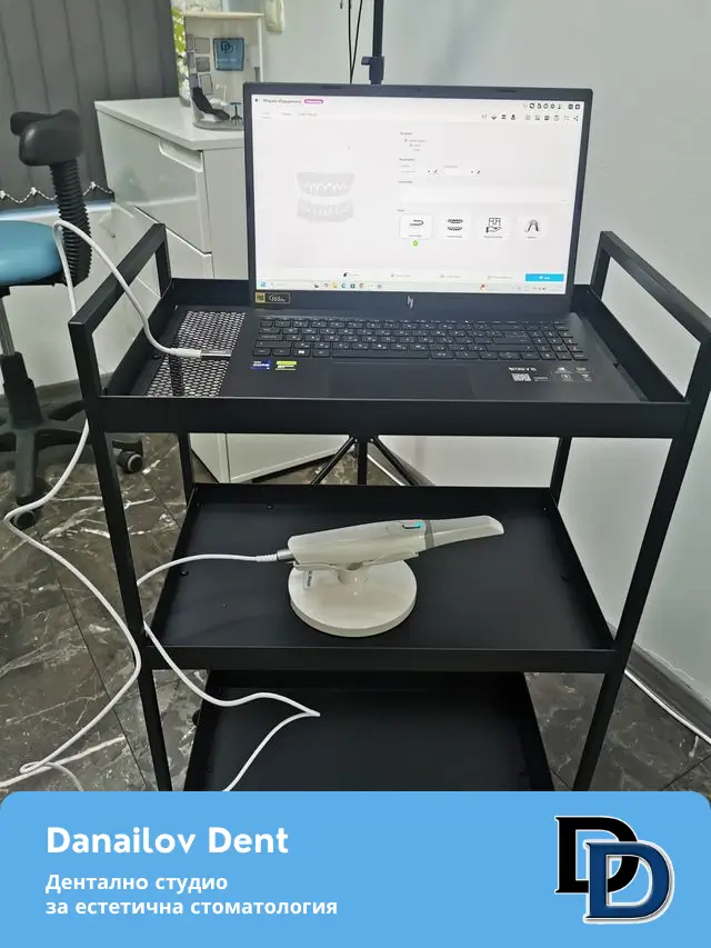 3d-skener-danailovdent-2.webp