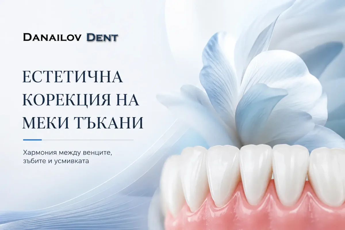 estetichna-korektsia-na-mekite-takani-danailovdent-1200x800.webp