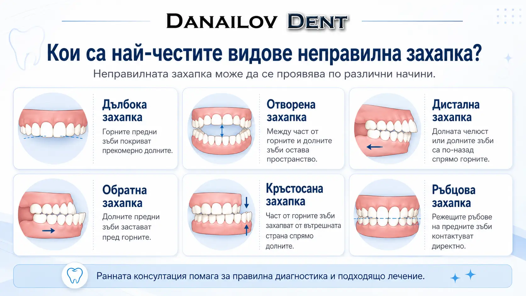 Неправилна захапка – кога е необходима консултация 1 nepravilna zahapka danailovdent